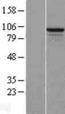 Western Blot: RSBN1L Overexpression Lysate [NBL1-15597]