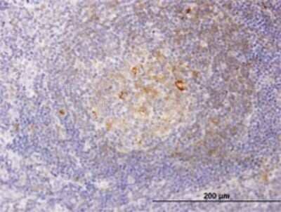 Immunohistochemistry-Paraffin: RSC1A1 Antibody (6F9) [H00006248-M01]