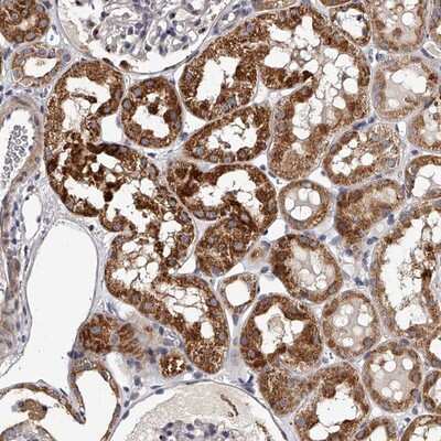 Immunohistochemistry-Paraffin: RSC1A1 Antibody [NBP1-80810]