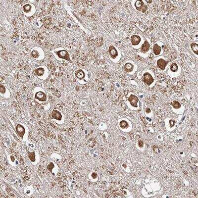 Immunohistochemistry-Paraffin: RSC1A1 Antibody [NBP1-80811]