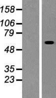 Western Blot: RSC1A1 Overexpression Lysate [NBP2-07609]