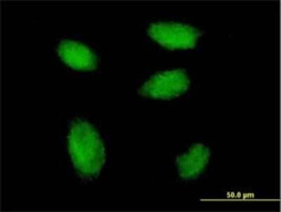 Immunocytochemistry/ Immunofluorescence: RSF1 Antibody (3E6) [H00051773-M05]