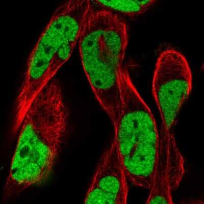 Immunocytochemistry/ Immunofluorescence: RSF1 Antibody [NBP2-56940]