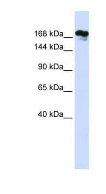 Western Blot: RSF1 Antibody [NBP1-52999]