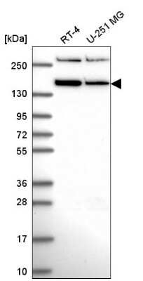 Western Blot: RSF1 Antibody [NBP2-57248]