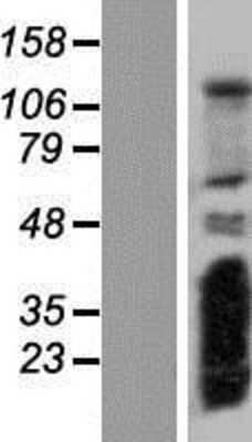 Western Blot: RSG1 Overexpression Lysate [NBP2-06166]