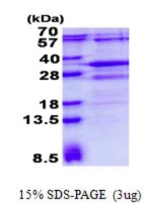 SDS-PAGE: Recombinant Human RSG1 His Protein [NBP2-23406]