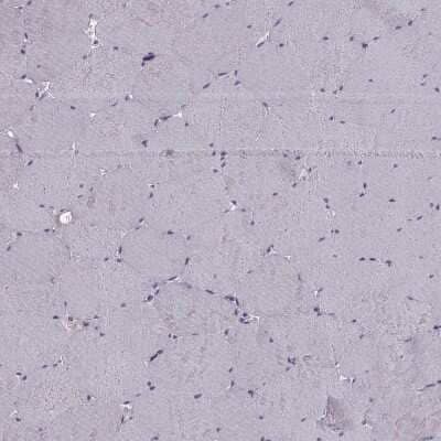 Immunohistochemistry-Paraffin: RSHL1 Antibody [NBP1-92356]
