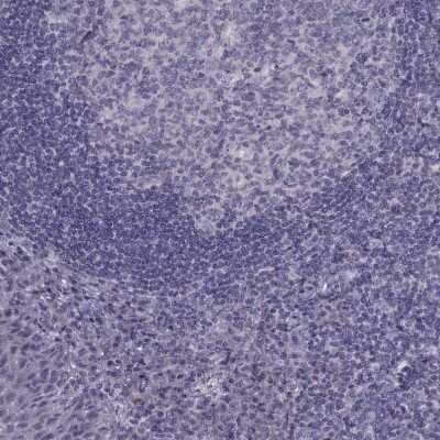 Immunohistochemistry-Paraffin: RSHL1 Antibody [NBP1-92356]