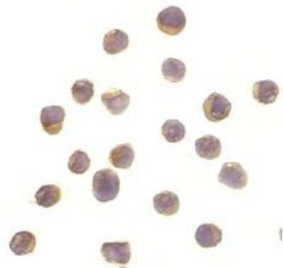 Immunocytochemistry/ Immunofluorescence: RSK1 Antibody - BSA Free [NBP1-76620]