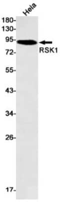 Western Blot: RSK1 Antibody (S02-2D2) [NBP3-20053]