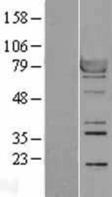 Western Blot: RSK1 Overexpression Lysate [NBL1-15570]