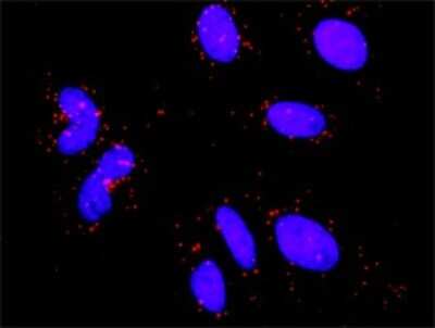 Proximity Ligation Assay: RSK2 Antibody (2G10) [H00006197-M01]