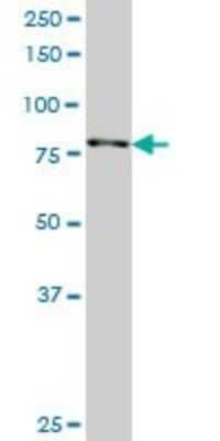 Western Blot: RSK2 Antibody (2G10) [H00006197-M01]