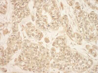 Immunohistochemistry: RSK2 Antibody [NBP1-30107]