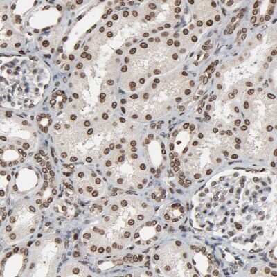 Immunohistochemistry-Paraffin: RSK2 Antibody [NBP1-85552]