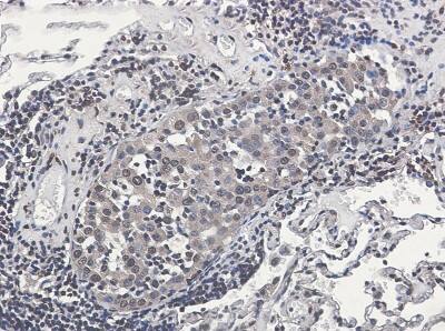 Immunohistochemistry-Paraffin: RSK2 Antibody (S05-6E3) [NBP3-19693]