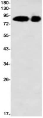 Western Blot: RSK2 Antibody (S05-6E3) [NBP3-19693]