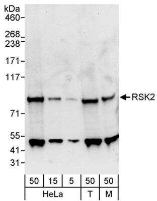 Western Blot: RSK2 Antibody [NBP1-30107]