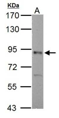 Western Blot: RSK2 Antibody [NBP2-20236]