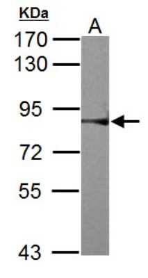 Western Blot: RSK2 Antibody [NBP2-20236]