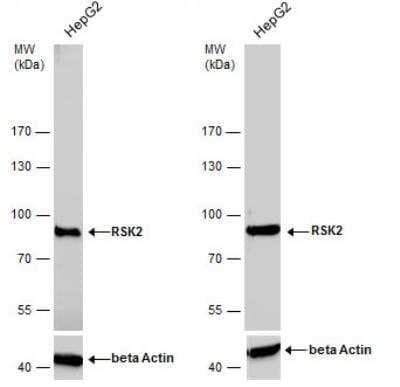 Western Blot: RSK2 Antibody [NBP2-20236]