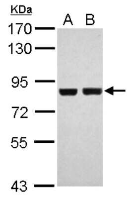 Western Blot: RSK2 Antibody [NBP2-20237]