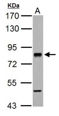 Western Blot: RSK2 Antibody [NBP2-20237]