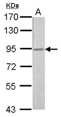 Western Blot: RSK2 Antibody [NBP2-20237]