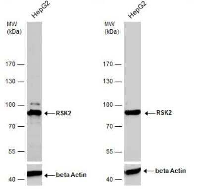 Western Blot: RSK2 Antibody [NBP2-20237]