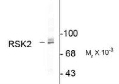 Western Blot: RSK2 Antibody [NBP2-29659]