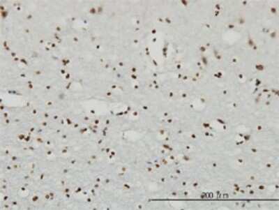 Immunohistochemistry-Paraffin: RSK3 Antibody (1F6) [H00006196-M01]