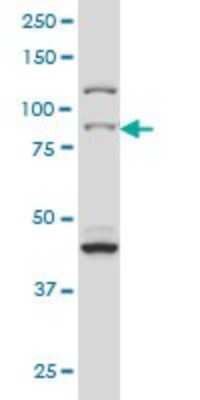 Western Blot: RSK3 Antibody (1F6) [H00006196-M01]