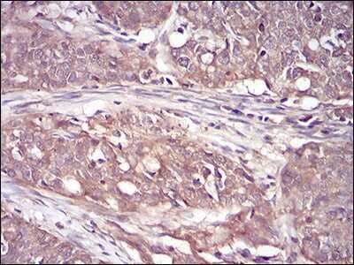 Immunohistochemistry-Paraffin: RSK3 Antibody (3C4C8) - BSA Free [NBP2-52555]