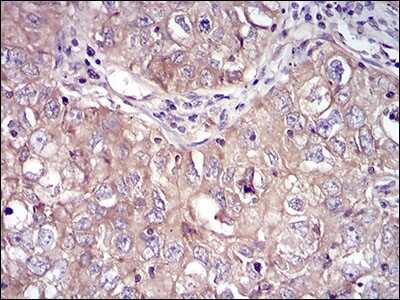 Immunohistochemistry-Paraffin: RSK3 Antibody (3C4C8) - BSA Free [NBP2-52555]
