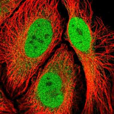 Immunocytochemistry/ Immunofluorescence: RSK3 Antibody [NBP2-48825]