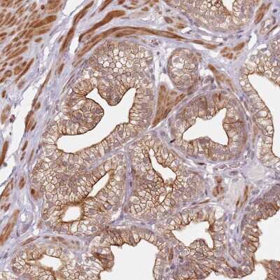 Immunohistochemistry-Paraffin: RSK3 Antibody [NBP2-48825]