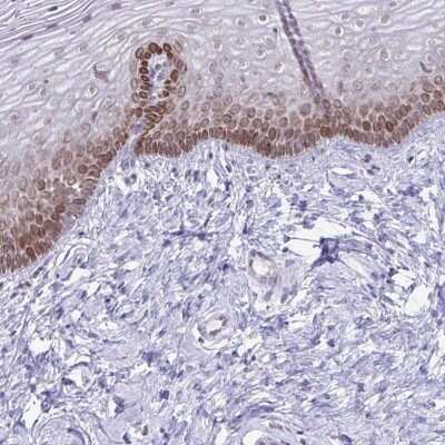 Immunohistochemistry-Paraffin: RSK3 Antibody [NBP2-49125]