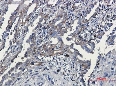 Immunohistochemistry-Paraffin: RSK3 Antibody (S05-5E4) [NBP3-19811]