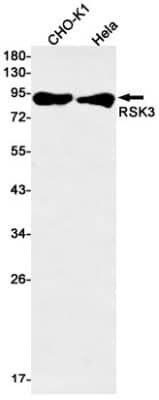 Western Blot: RSK3 Antibody (S05-5E4) [NBP3-19811]