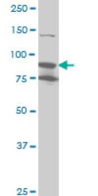 Western Blot: RSK4 Antibody (3A1) [H00027330-M01]