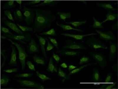 Immunocytochemistry/ Immunofluorescence: RSK4 Antibody (3G12) [H00027330-M06]