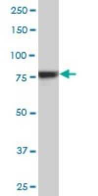 Western Blot: RSK4 Antibody (6F2) [H00027330-M02]