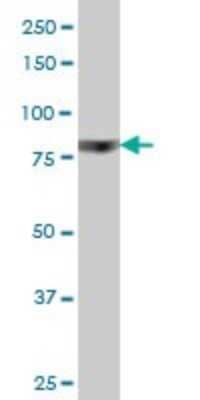 Western Blot: RSK4 Antibody (8H5) [H00027330-M03]