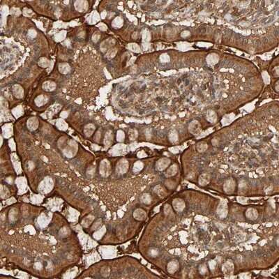 Immunohistochemistry-Paraffin: RSK4 Antibody [NBP1-87107]