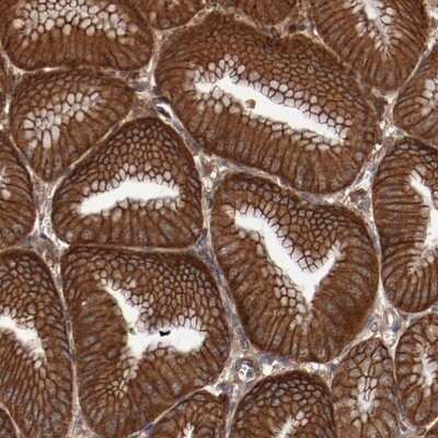 Immunohistochemistry-Paraffin: RSK4 Antibody [NBP1-87108]