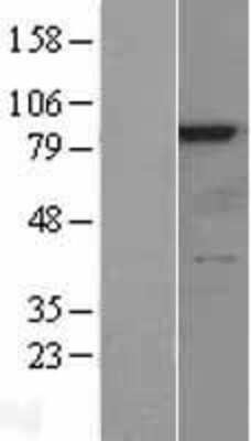 Western Blot: RSK4 Overexpression Lysate [NBL1-15573]