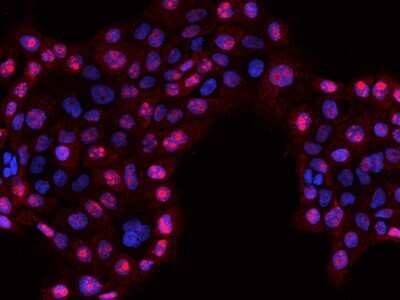 Immunocytochemistry/ Immunofluorescence: RSL1D1 Antibody [NBP2-97626]