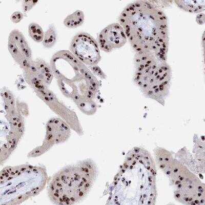 Immunohistochemistry-Paraffin: RSL1D1 Antibody [NBP2-13269]
