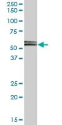 Western Blot: RSL1D1 Antibody [H00026156-B01P]